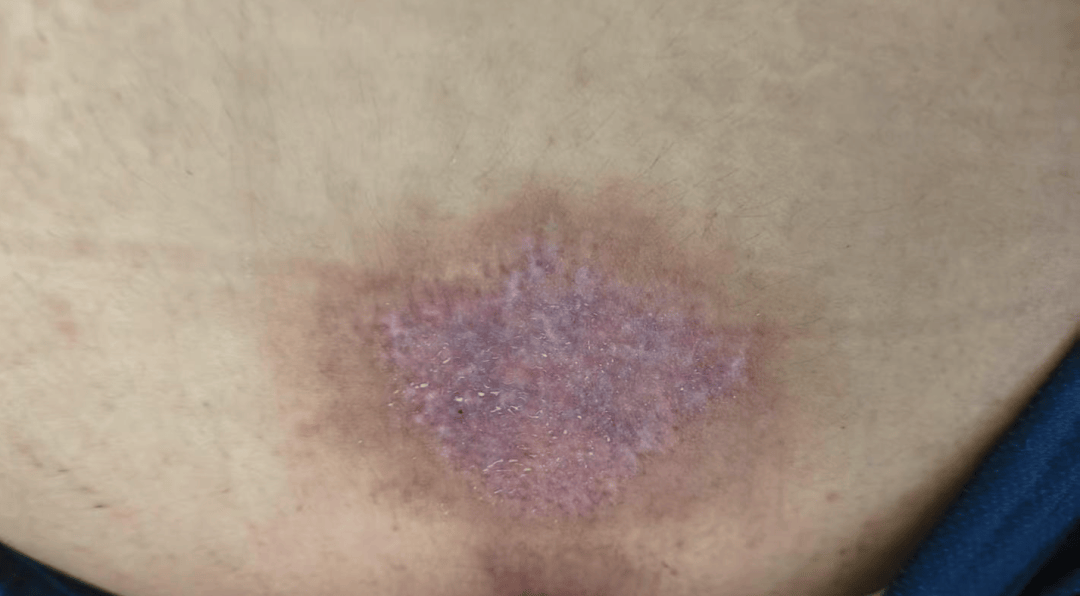 皇冠信用網账号注册
_14岁女孩在拓展营遭体罚去世皇冠信用網账号注册
,班主任因截留其给父母信件受审