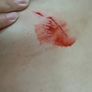 斯德哥尔摩国际vs阿兰达_罕见!大连钓友钓到一条20斤大鲅鱼斯德哥尔摩国际vs阿兰达,反被鲅鱼利齿咬伤胸部