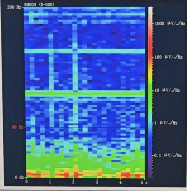 皇冠信用网会员
_山西首例皇冠信用网会员
！山西省人民医院成功实施脑机接口辅助功能区脑肿瘤切除手术